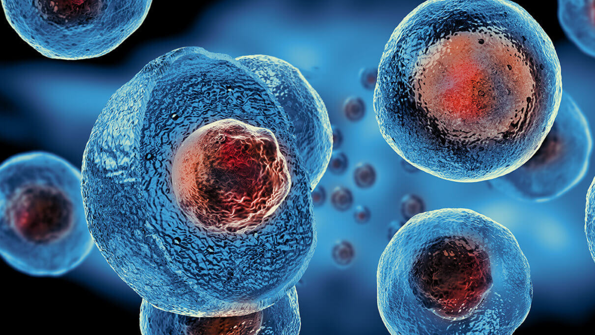 Registered nurse preparing stem cell IV therapy at iCRYO Marietta
